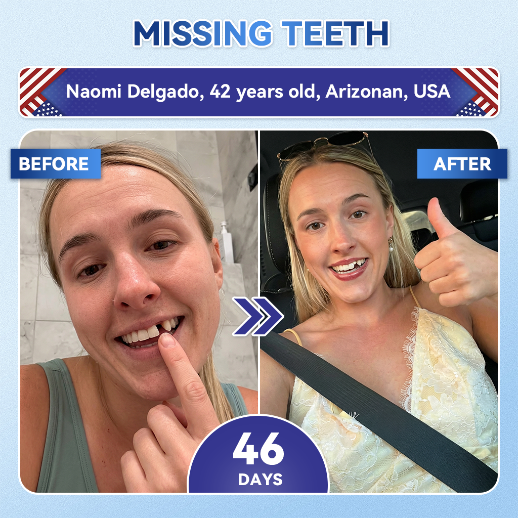 Lumeyvive® 🦷 Tideglusib Fast‑Dissolving Tooth & Gum Repair Oral Strips ✨