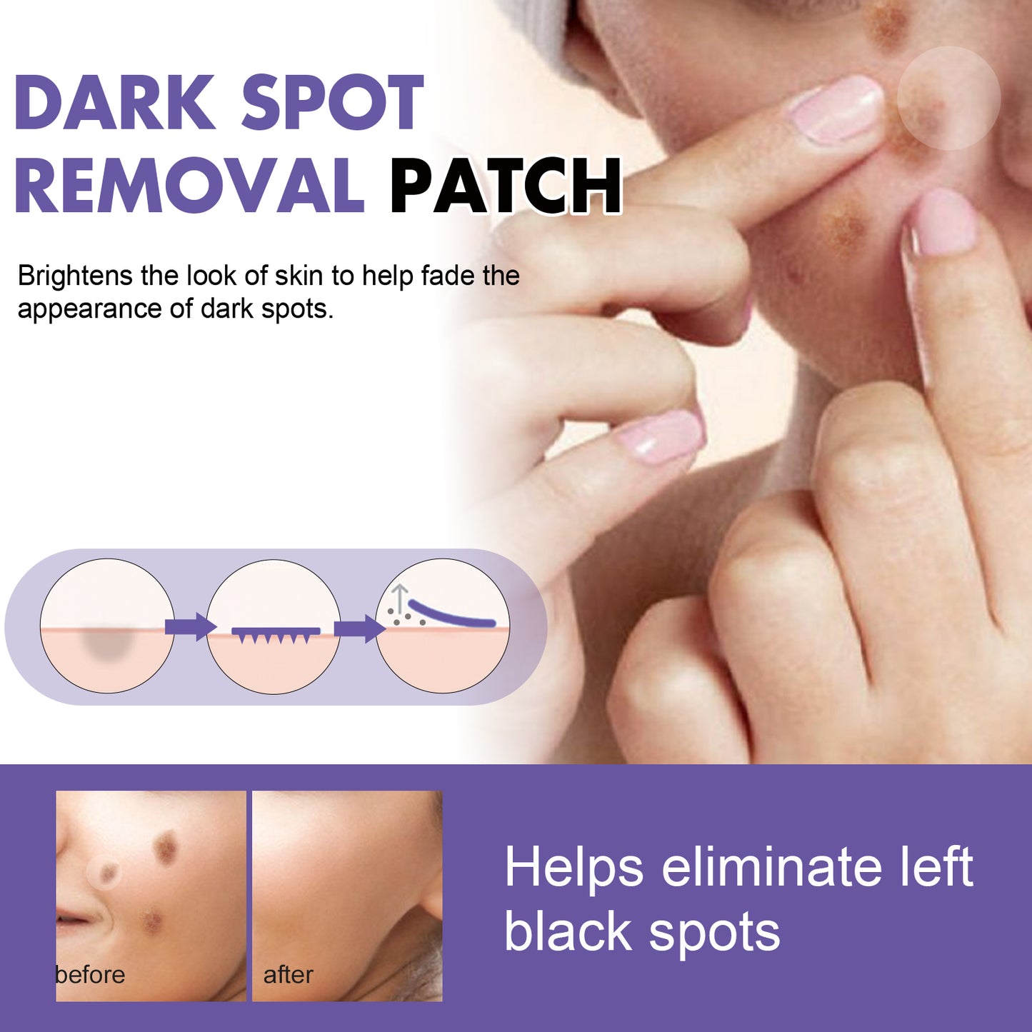 EELHOE Dark Spot Treatment Patch