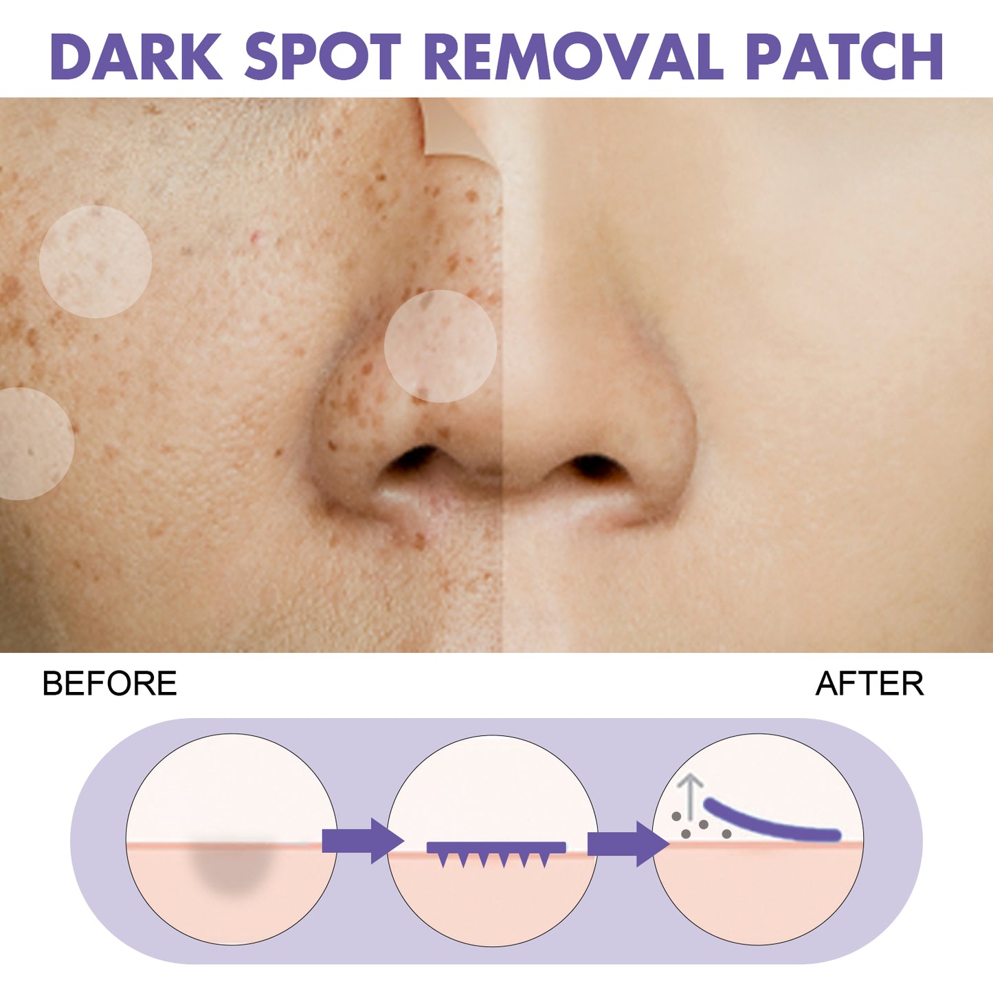 EELHOE Dark Spot Treatment Patch