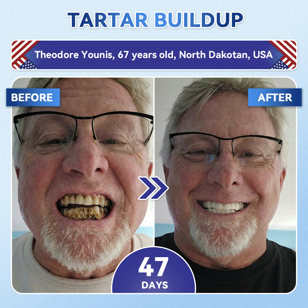 Lumeyvive® 🦷 Tideglusib Fast‑Dissolving Tooth & Gum Repair Oral Strips ✨