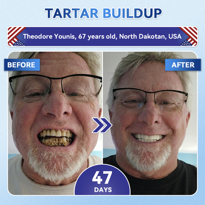 Lumeyvive® 🦷 Tideglusib Fast‑Dissolving Tooth & Gum Repair Oral Strips ✨