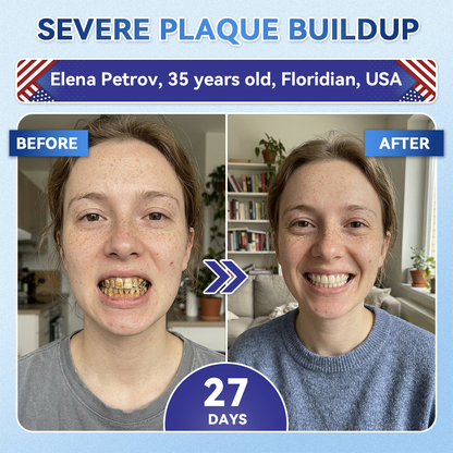 Lumeyvive® 🦷 Tideglusib Fast‑Dissolving Tooth & Gum Repair Oral Strips ✨