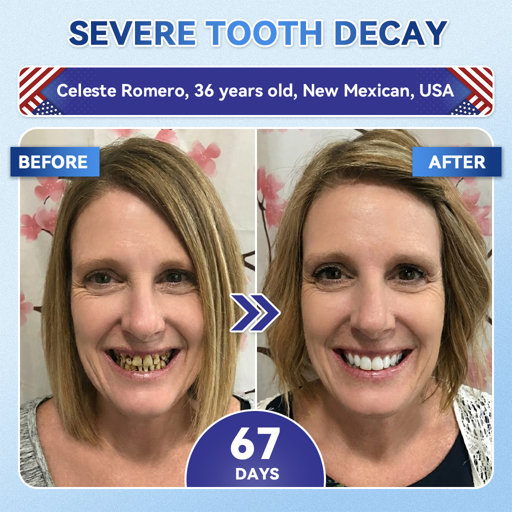 Lumeyvive® 🦷 Tideglusib Fast‑Dissolving Tooth & Gum Repair Oral Strips ✨