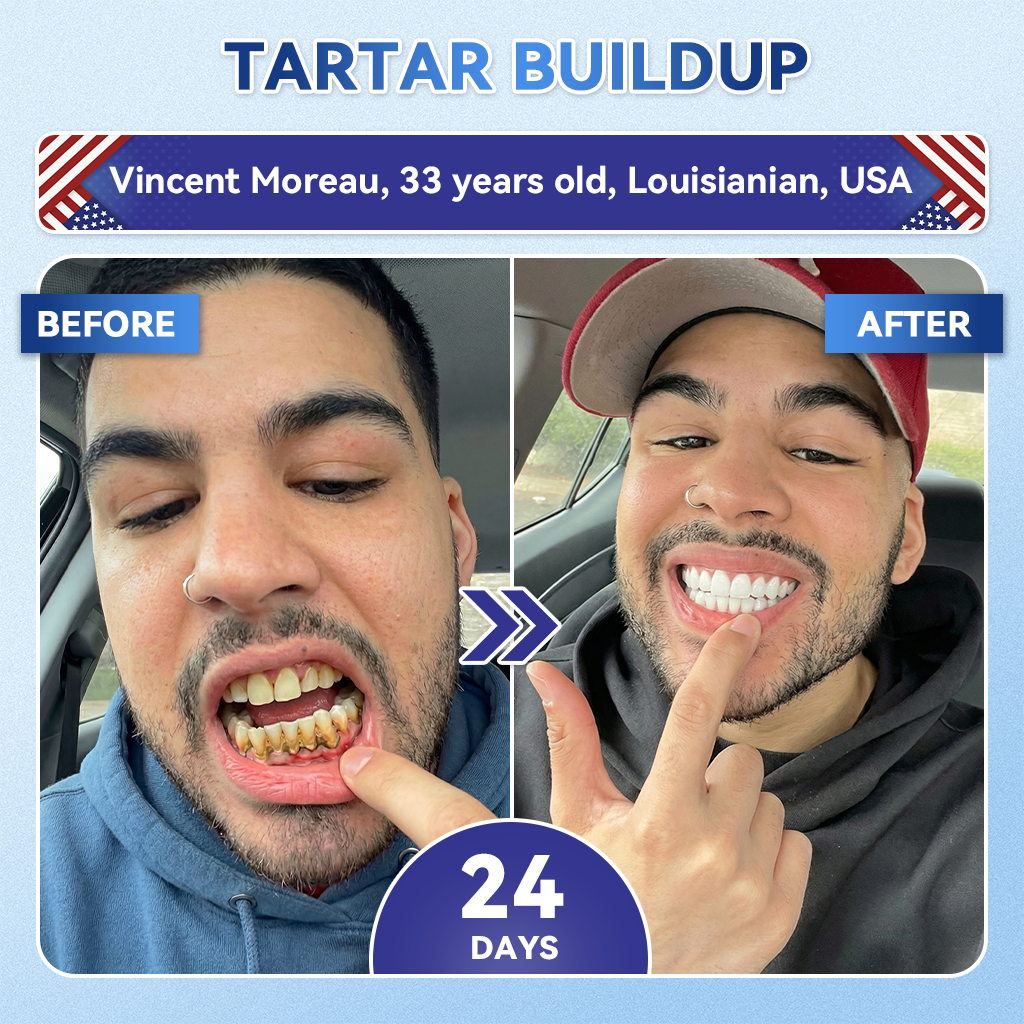 Lumeyvive® 🦷 Tideglusib Fast‑Dissolving Tooth & Gum Repair Oral Strips ✨