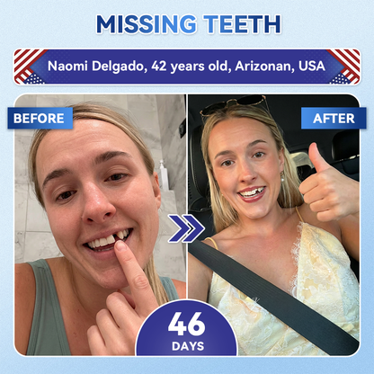 Lumeyvive® 🦷 Tideglusib Fast‑Dissolving Tooth & Gum Repair Oral Strips ✨