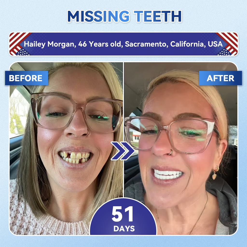 Lumeyvive® 🦷 Tideglusib Fast‑Dissolving Tooth & Gum Repair Oral Strips ✨